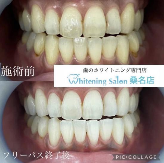 歯のホワイトニング専門店 ホワイトニングサロン三重県桑名店(写真 1)